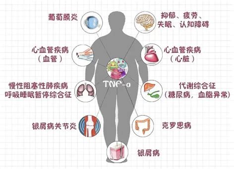 多病|健康科普：专家分析，为什么老年人大多「多病共存」